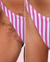 Bella Skin 3 en 1 – Loción Corporal Hidratante y Aclarante